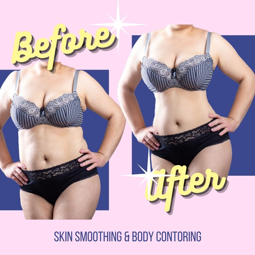 Skin smoothing before and after