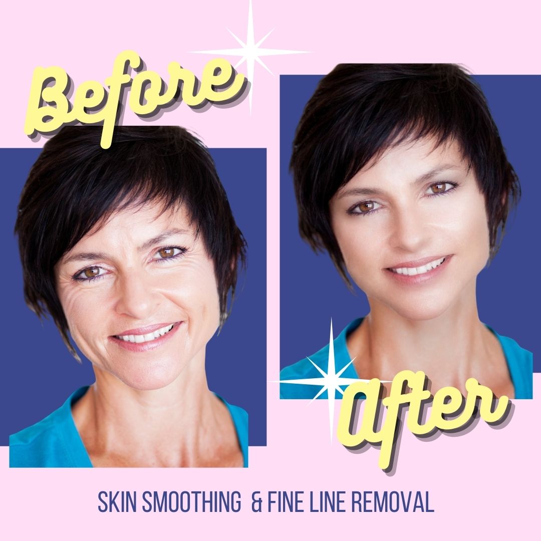 Skin smoothing and fine line removal photo editing